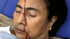 మమతా బెనర్జీకి గాయం, ఆసుపత్రిలో చికిత్స