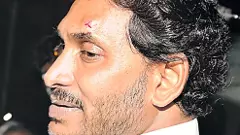 సీఎం జగన్‌పై రాయిదాడిలో పోలీసుల ఘోర వైఫల్యం