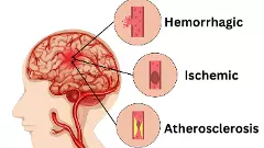 మీ మెదడు ఎంత భద్రం! ఎప్పుడైనా డాక్టర్ కి చూపించుకున్నారా?
