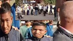 Bald Hair | బుల్దానా జిల్లా 11 గ్రామాలవాసులకు బట్టతల, ఎందుకంటే...