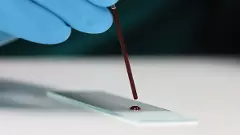 Meerpet Murder | ఒక్క రక్తపు చుక్క హంతకుడిని  పట్టించింది...