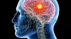 ఆంధ్రప్రదేశ్ లో బ్రెయిన్ హెల్త్ ఇనిషియేటివ్ ప్రోగ్రామ్