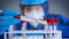 స్వల్పంగా పెరిగిన కోవిడ్ కేసులు..