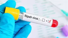 కేరళలో నిపా వైరస్ కలకలం.. మూడు జిల్లాల్లో హై అలర్ట్