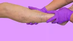 అమెరికా అధ్యక్షుడు ట్రంప్‌నకు CVI..