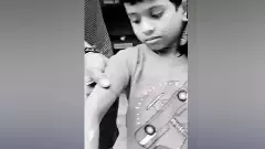 అట్ల కాడతో చిన్నారికి వాతలు