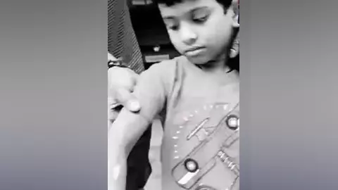 అట్ల కాడతో చిన్నారికి వాతలు