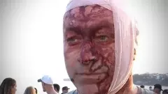 ఆస్ట్రేలియాలో యూదుల లక్ష్యంగా కాల్పులు, 12 మంది మృతి