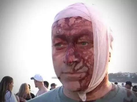 ఆస్ట్రేలియాలో యూదుల లక్ష్యంగా కాల్పులు, 12 మంది మృతి ఆస్ట్రేలియాలో యూదుల లక్ష్యంగా కాల్పులు, 12 మంది మృతి