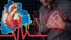 తెలంగాణకు పెరుగుతున్న గుండెపోటు