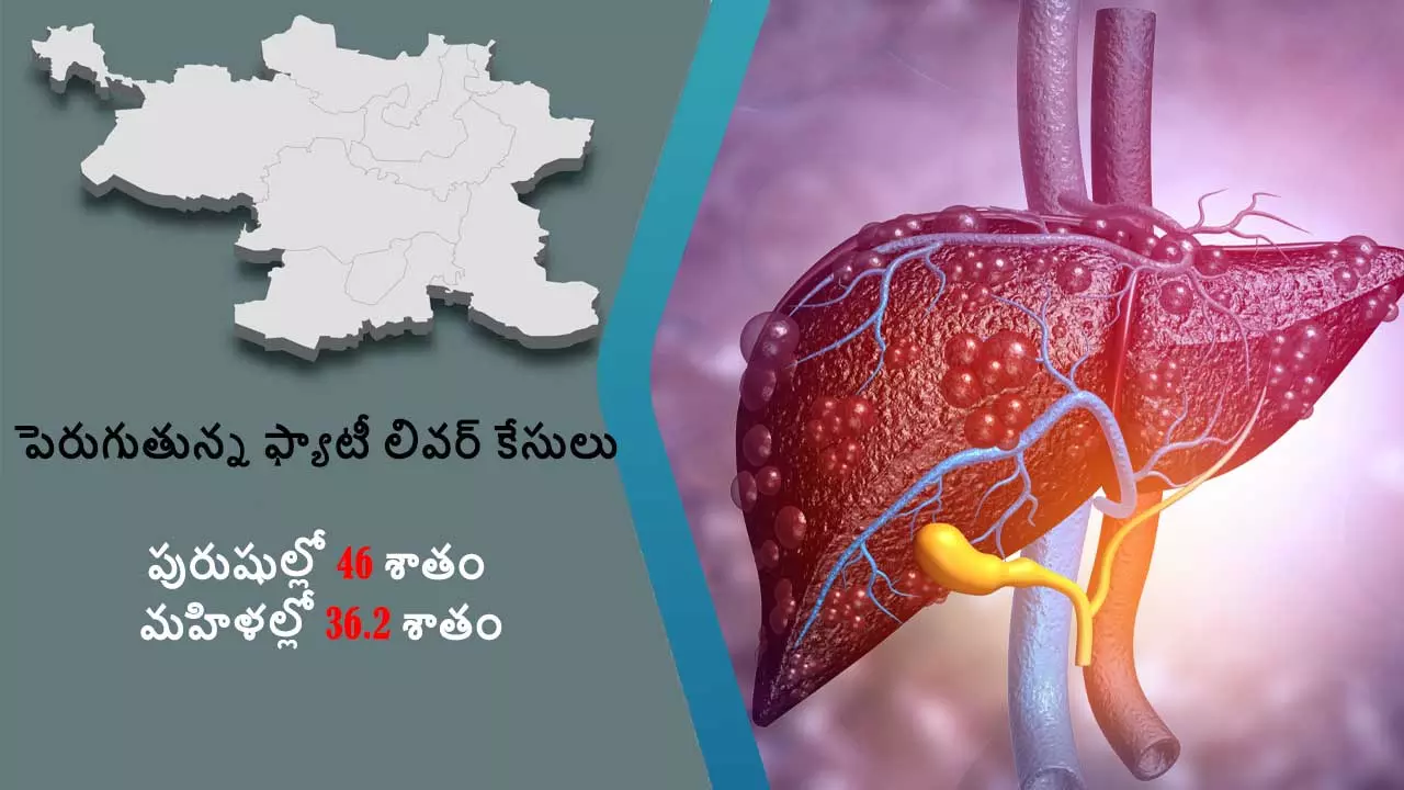 హైదరాబాద్‌లో 40.9% మందికి ఫ్యాటి లివర్