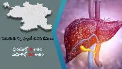 హైదరాబాద్‌లో 40.9% మందికి ఫ్యాటి లివర్